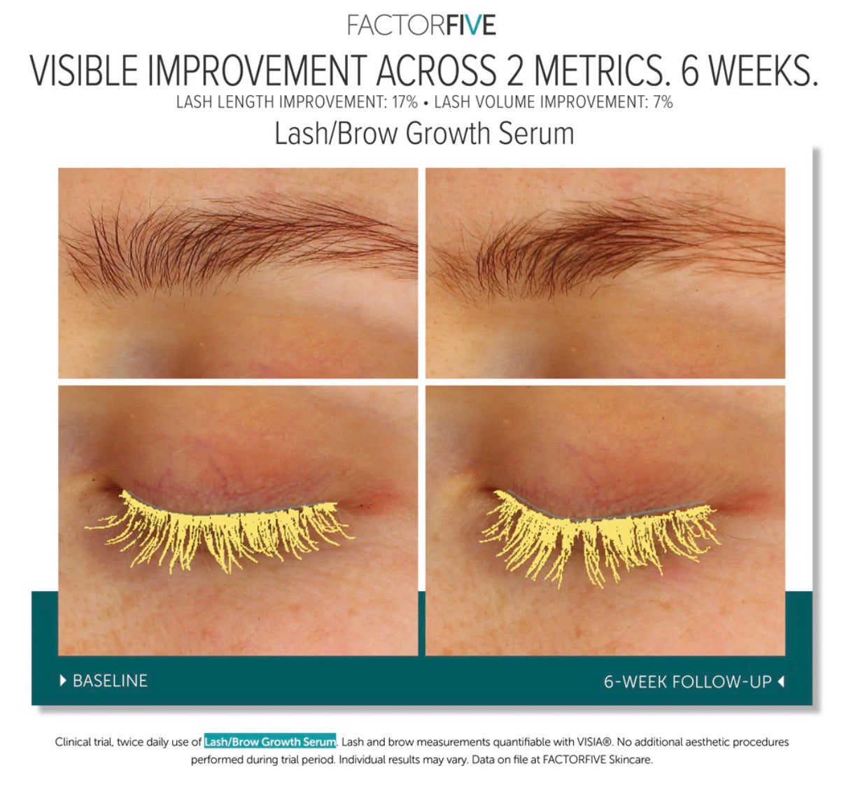 Factor Five Lash/Brow Growth Serum