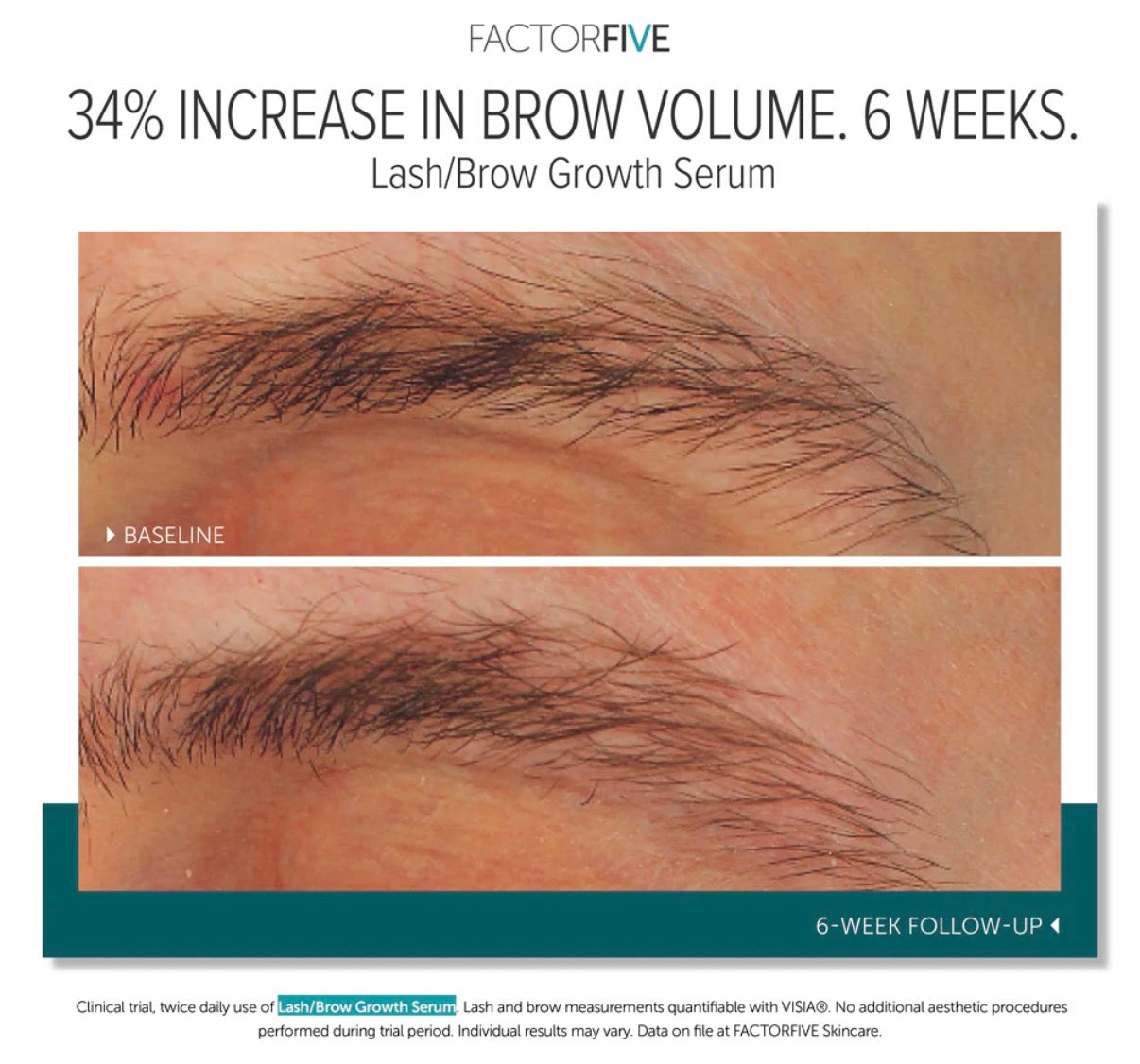 Factor Five Lash/Brow Growth Serum